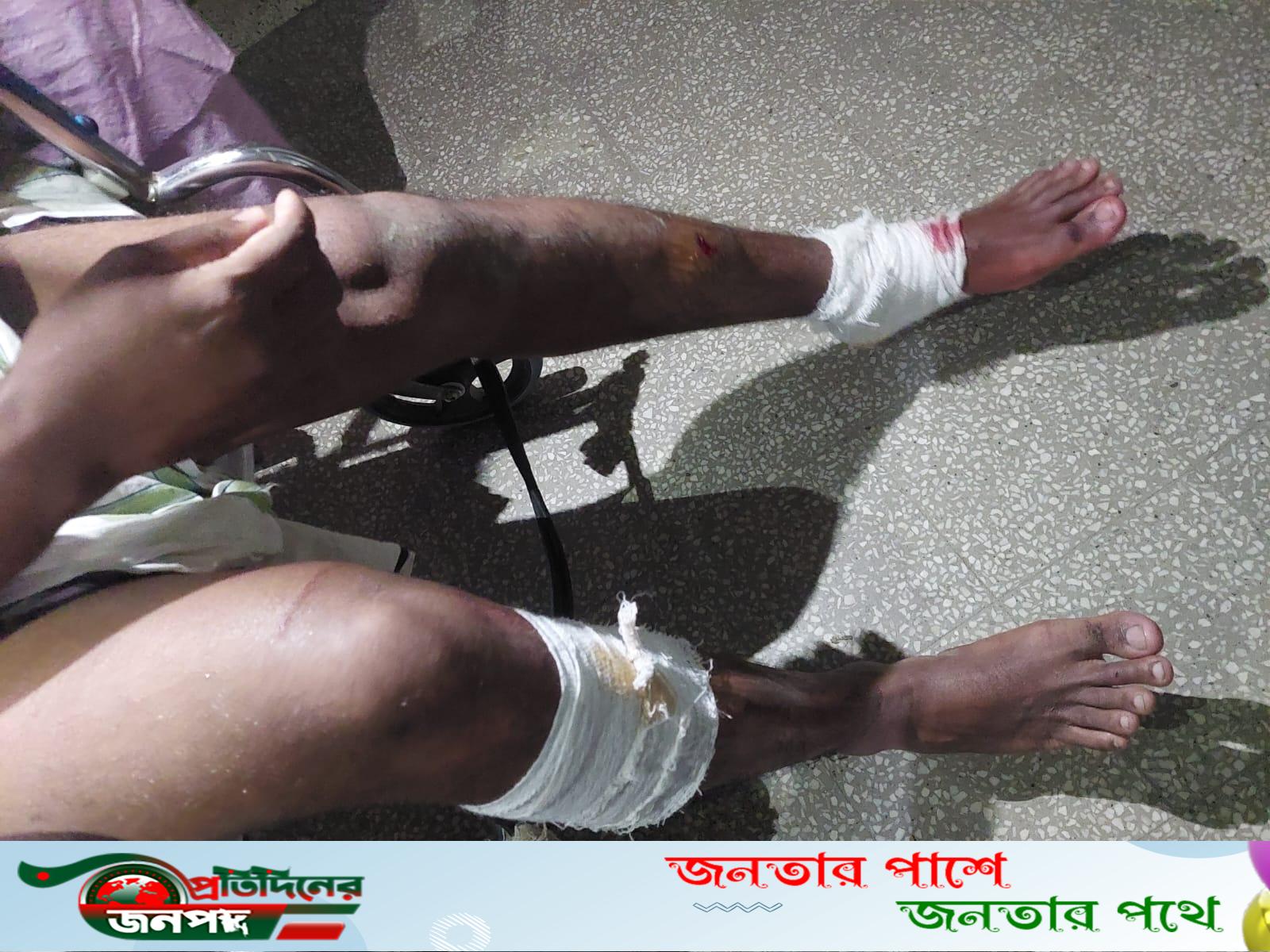 ভাঙ্গুড়ায় বসত বাড়িতে সন্ত্রাসী হামলা-ভাংচুর, শিশু-মহিলাসহ আটজনকে বেধড়ক পিটিয়ে জখম